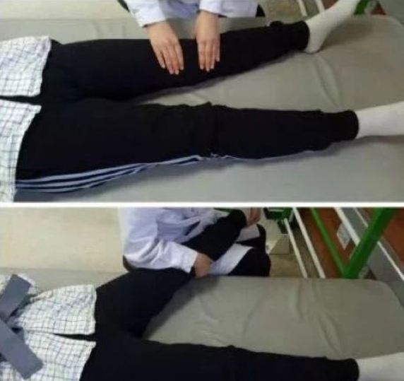 膝過(guò)伸不煩惱，康復(fù)訓(xùn)練有妙招